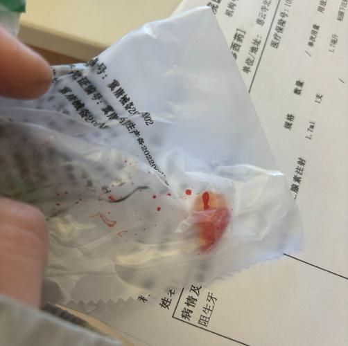 一次被拔9颗牙进ICU，一次性拔9颗牙
