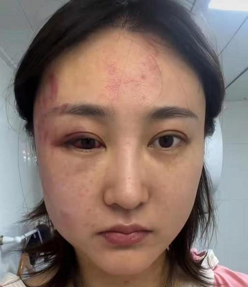 百万网红拒还债被捕，百万网红遭家暴