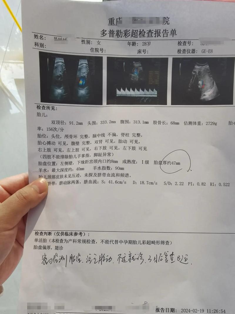 生完4个月再怀双胎，生完一胎四个月怀二胎