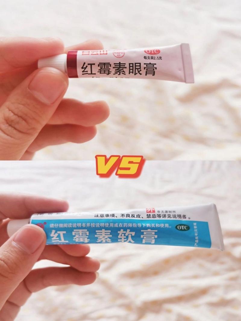 红霉素软膏眼膏区别，红霉素软膏眼膏区别大吗