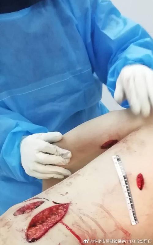 工地睡觉时被捅身亡，
